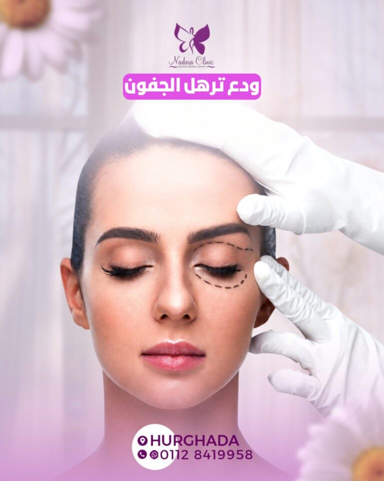 علاج ترهل الجفون في الغردقة